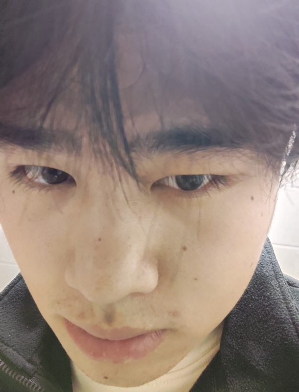 伤男的第一张照片--诏安交友网